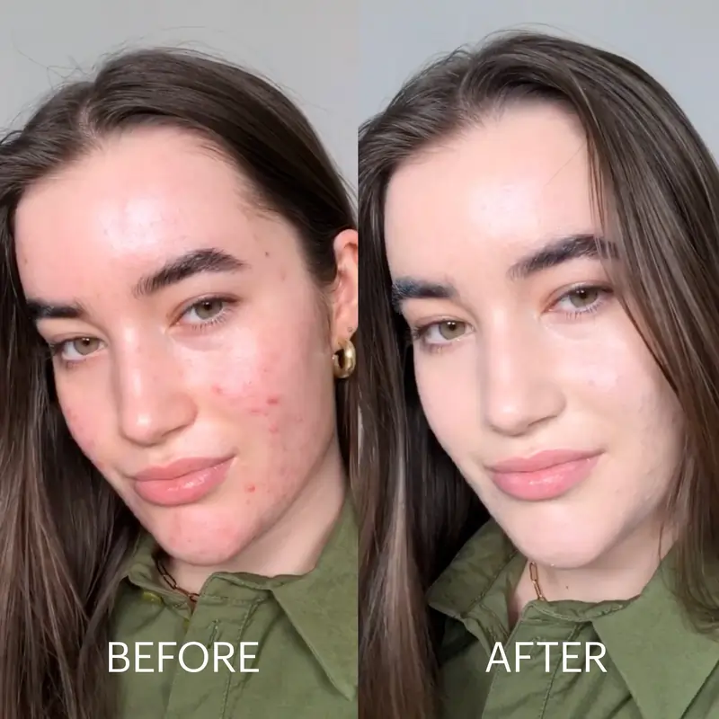primebiome skin health